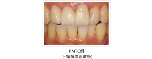 PMTC例