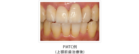 PMTC例